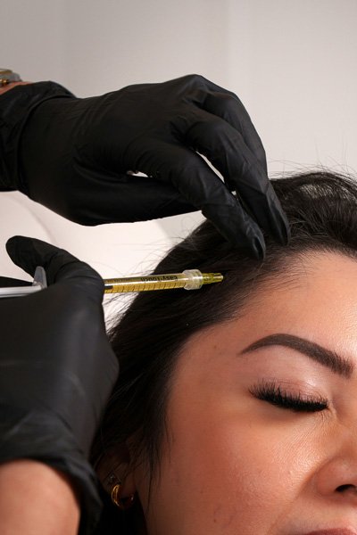 Injection being administered into a patient's scalp
